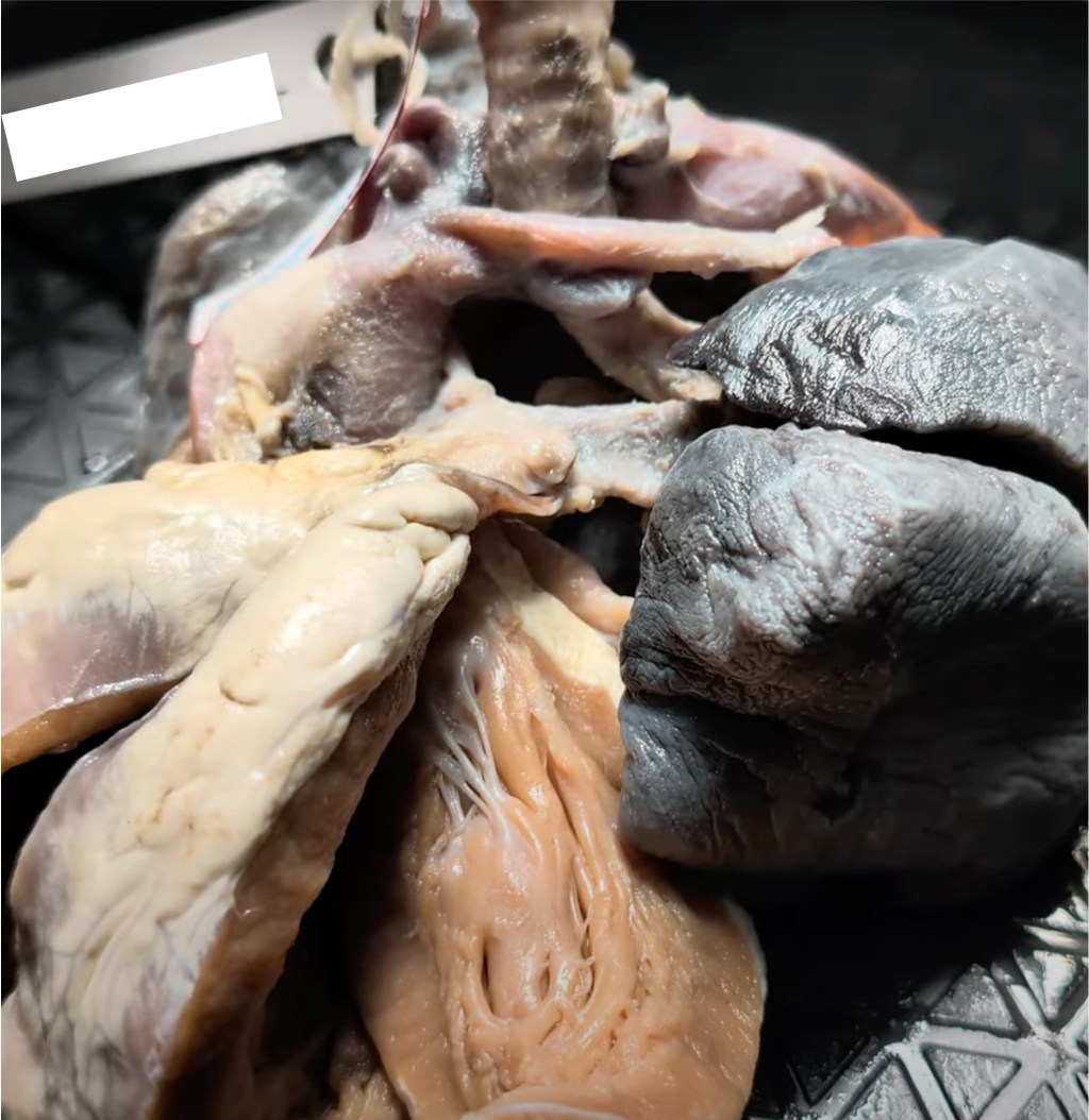 Why do we call it “mirror image branching”?